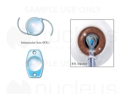 Artificial Lens Replacement