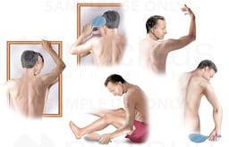 Melanoma Self Exam