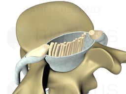 Lumbar Vertebrae Spinal Nerves and Dura