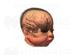 Skull and Brain Ghosted in Baby's Head