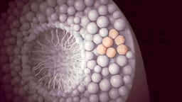 Testicular Cancer