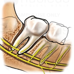 Teeth and Nerves Within Mandible