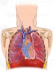 Pulmonary Circulation