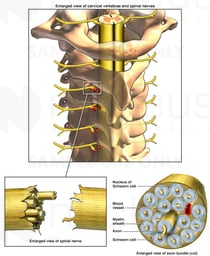 Avulsion of Spinal Nerves Supplying the Brachial Plexus