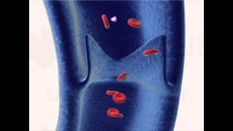 Vein (Venous) Valve - Mechanism of Action