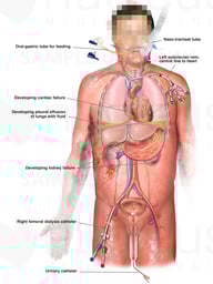 Immediate Medical Condition