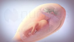 Twin-to-Twin Transfusion Syndrome