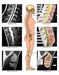 Knee, Neck and Lower Back Injuries