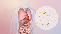 What is High Potassium (Hyperkalemia)?