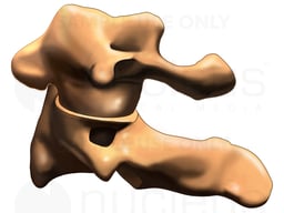 C1, C2 Vertebrae, Lateral View