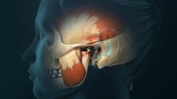 Pain: Common Symptom of TMJ Disorders