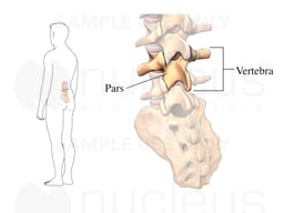 Pars: Posterolateral View