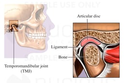 Temporomandibular Joint (TMJ)