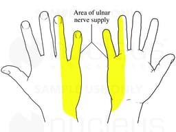 Ulnar Nerve Innervation in the Hand