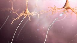 Neurons with Diffuse Axonal Injury