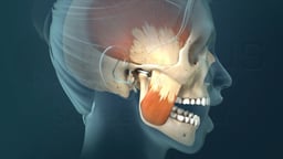 TMJ Disorders (TMD)