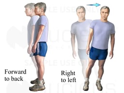 Exercises for Vertigo: Standing Sway