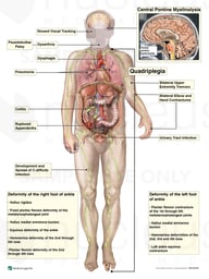 Multiple Pathologies