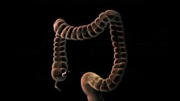 Large Intestine with Endoscope Highlighting the Sigmoid Colon