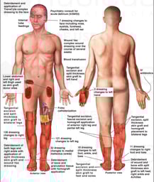 Multiple Surgical Procedures