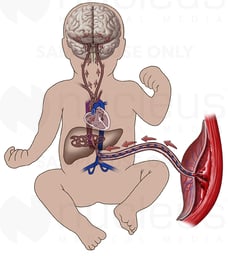 Fetal Circulation