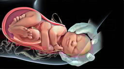 What is Stage 2 of Labor? 