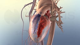 Left-Sided Heart Failure