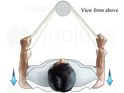 Scapular Exercise: Arm Reach