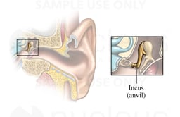 The Incus