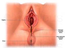 Third Degree Vaginal Tear