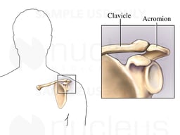 Clavicle-Acromion Joint