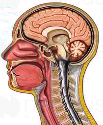 Cut-away View of Head - Pathology
