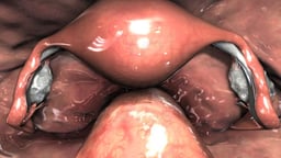 Diagnostic Pelvic Laparoscopy