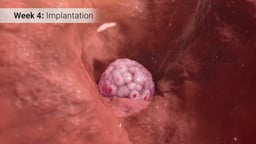 Implantation of Blastocyst