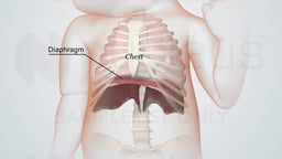 Infant Thoracic Anatomy: Diaphragm and Chest Cavity