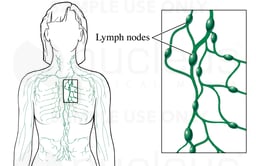 Lymph Nodes