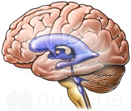 Brain with Ventricles (Lateral View)