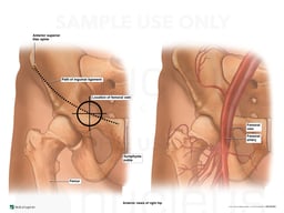 Anatomy of the Right Inguinal Region