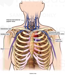 Venous Anatomy of the Upper Thorax