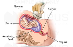 Ultrasound