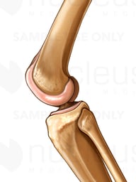 Knee Bones Flexed, Lateral View