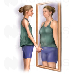 Anorexia Nervosa