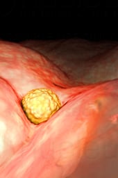 Week 04 - Implantation