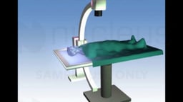 Coronary Artery Angiography Procedure