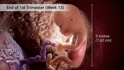 Fetus at Week 13 of Pregnancy