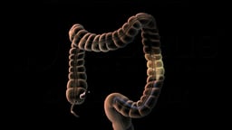 Large Intestine with Endoscope Highlighting the Descending Colon
