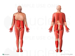 Multiple Surgical Repairs