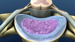 Cervical (Neck) Intervertebral Disc Anatomy