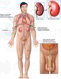 Medical Interventions