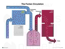 The Fontan Circulation Diagram